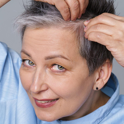 Detener con éxito la caída del cabello